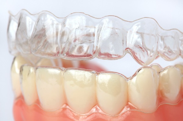 Ventajas de la ortodoncia en los adultos