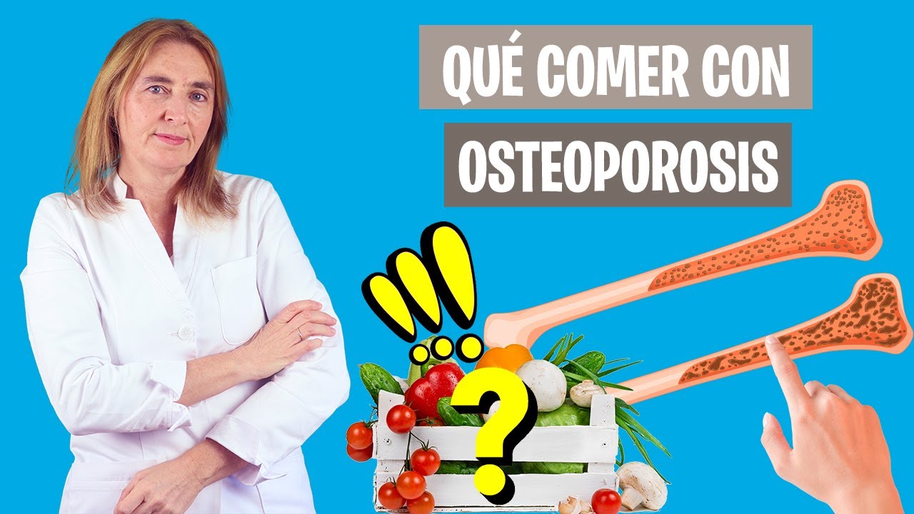 como-afecta-la-alimentacion-a-Como-prevenir-la-osteoporosis-en-mujeres - Revista DeBelleza.Es cómo afecta la alimentación a Cómo prevenir la osteoporosis en mujeres