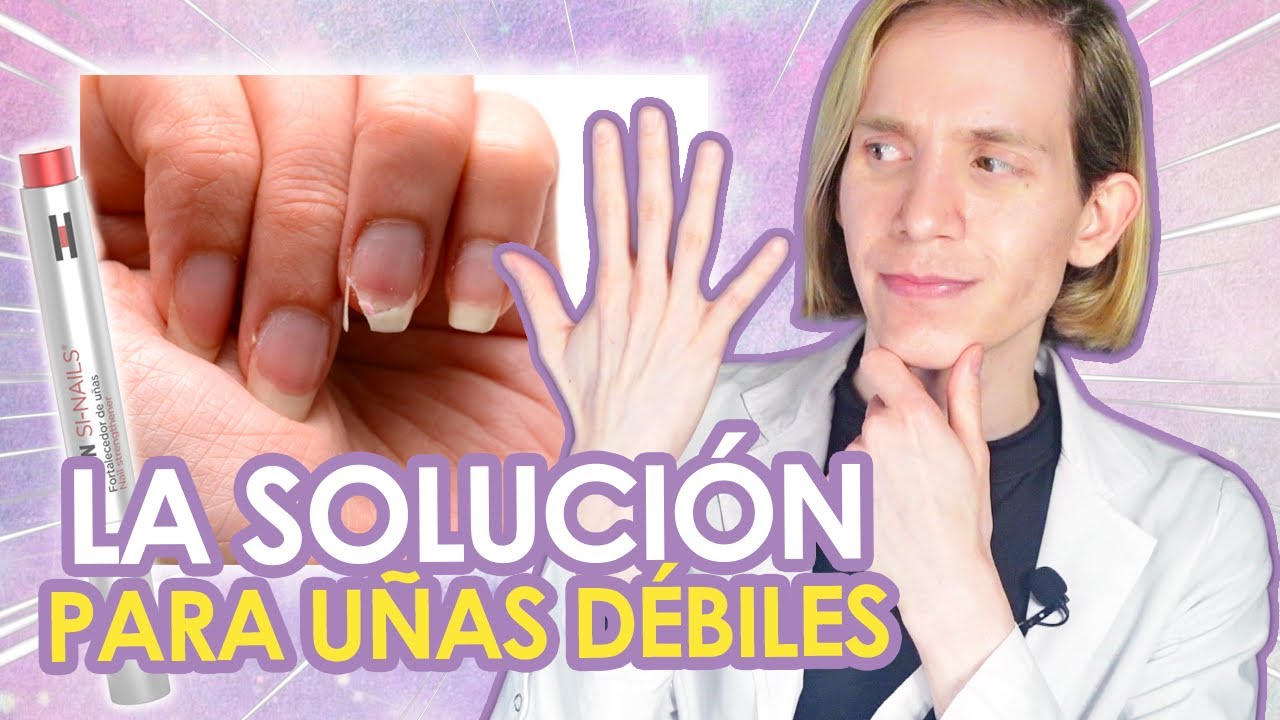 qué opinan los expertos sobre Cómo fortalecer las uñas con remedios caseros